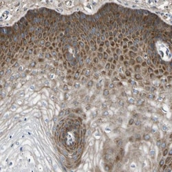 MSPR/Ron Antibody, Novus Biologicals 0.1mL; Unlabeled:Antibodies, Polyclonal